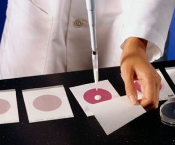 Petrifilm Plates: Easy And Effective 1