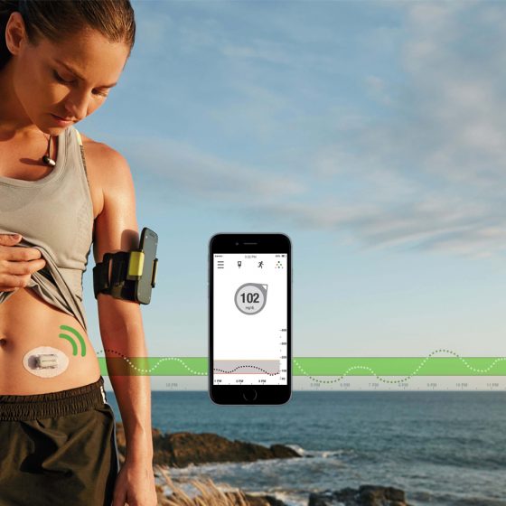 Dexcom G5